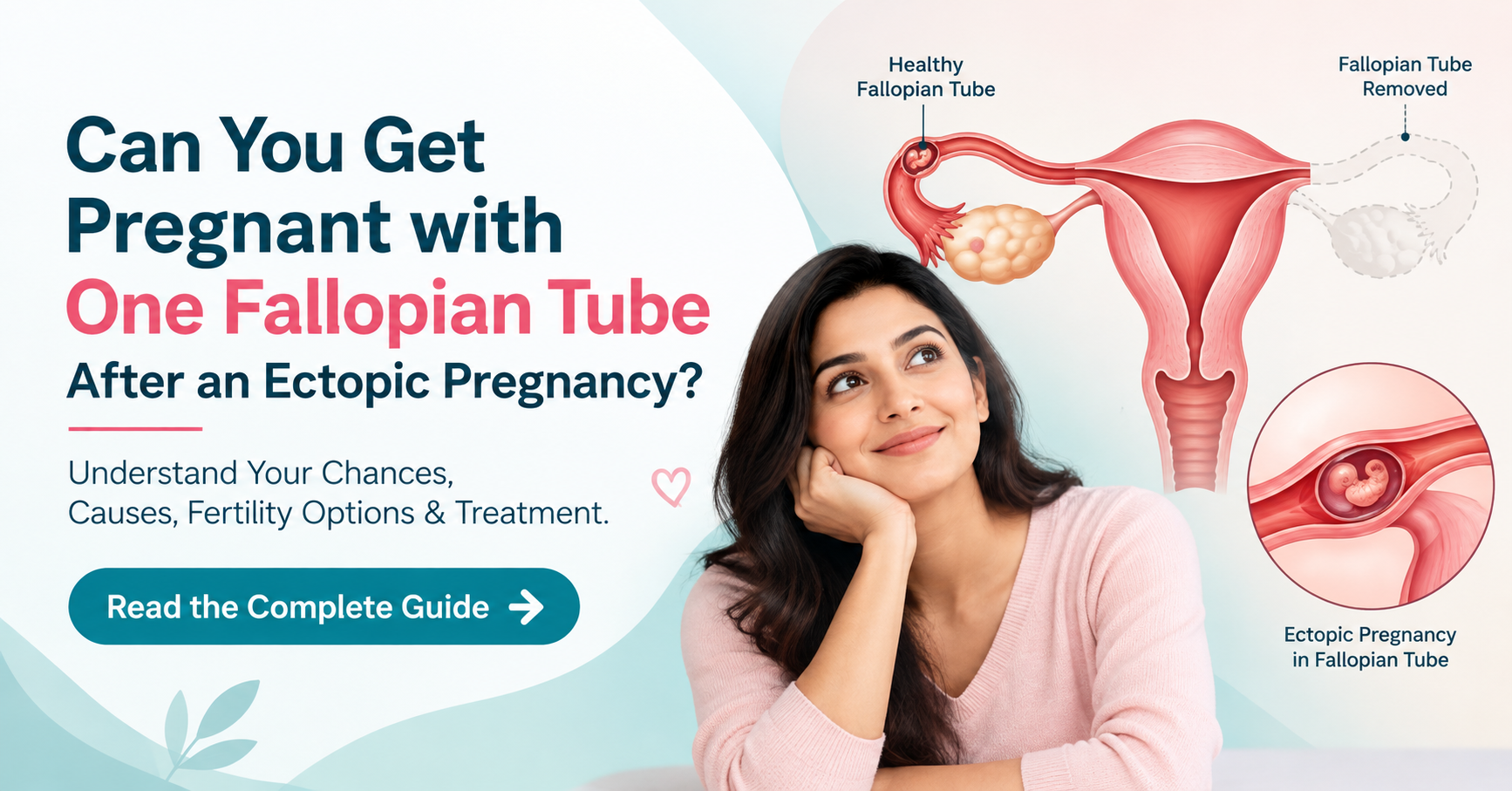Can You Get Pregnant with One Fallopian Tube After an Ectopic Pregnancy?